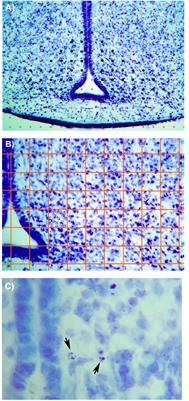 Prenatal Low-Protein and Low-Calorie Diets Differentially Alter Arcuate Nucleus Morphology in Newborn Male Rats